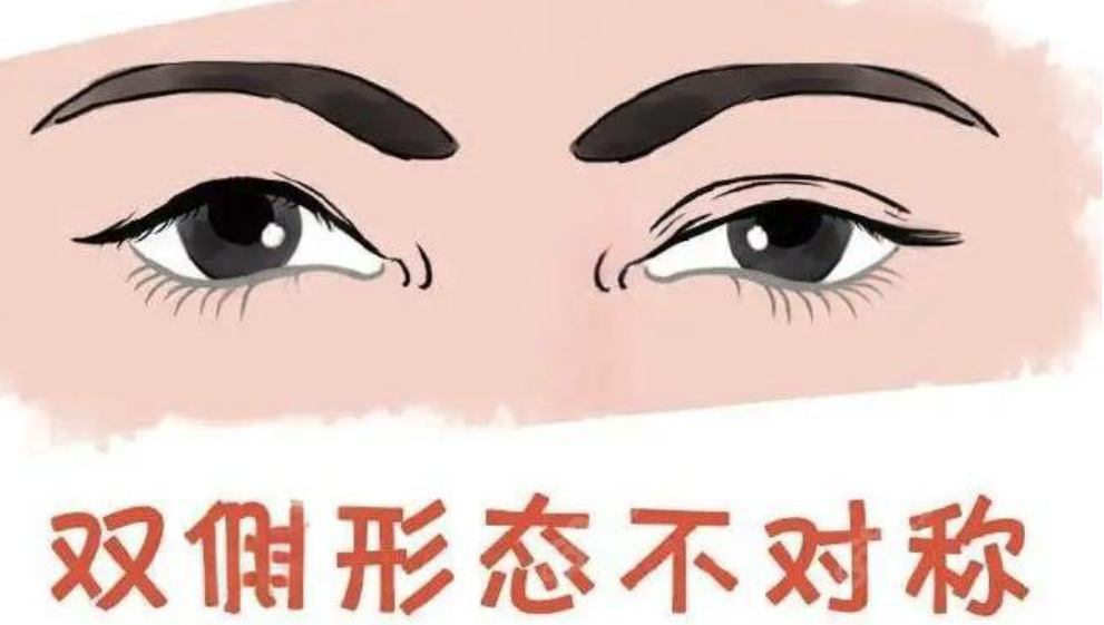 上海馬娟醫(yī)生眼修復(fù)技術(shù)評價：“修復(fù)后閉眼無痕”，價格透明 