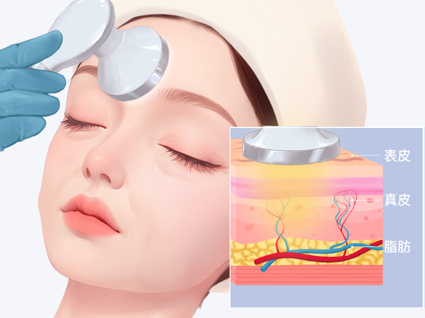 韓國mods皮膚科激光美容成效好