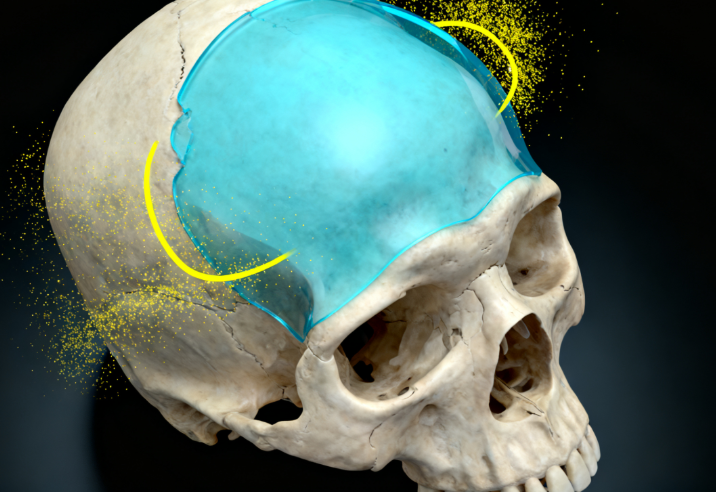 韓國(guó)頭扁整形