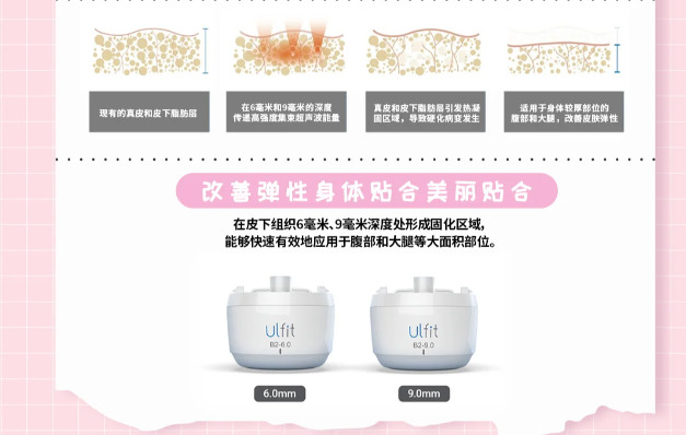 韓國ULFIT優(yōu)飛塑 優(yōu)勢總結??