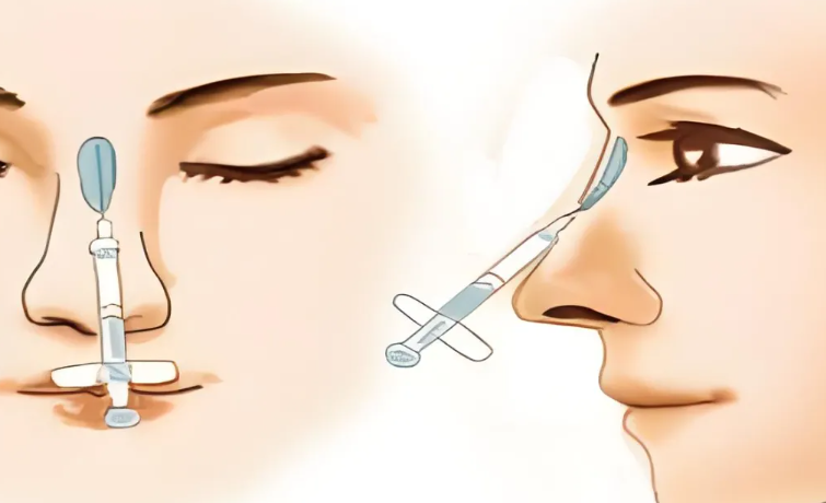 艾絲樂(lè)骨性材料屬于什么檔次？適合打鼻子和維持2年起揭曉中高端實(shí)力！