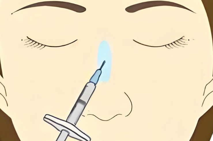 艾絲樂骨性材料有風險嗎？