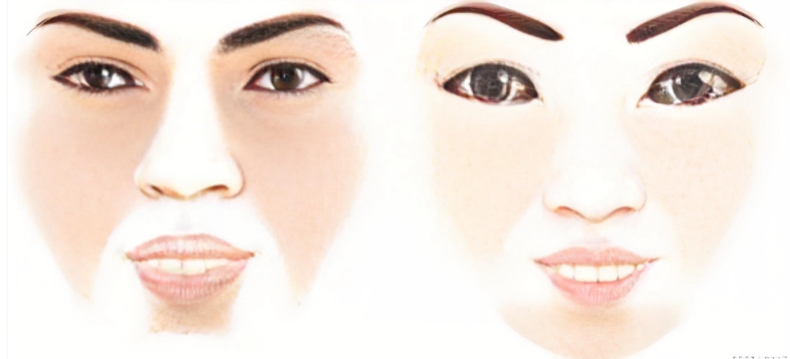 李澤人中縮短人中窩做的好不好？做過(guò)的患者反饋術(shù)后疤痕隱蔽及幼態(tài)感明顯 