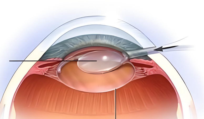 針對老年人的免費政策：穩(wěn)準(zhǔn)幫扶，關(guān)愛老年群體