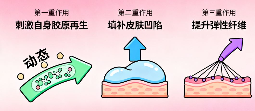 上海李敏灌注提升的體驗