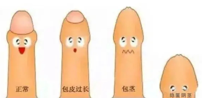 王文卫医生的手术收费