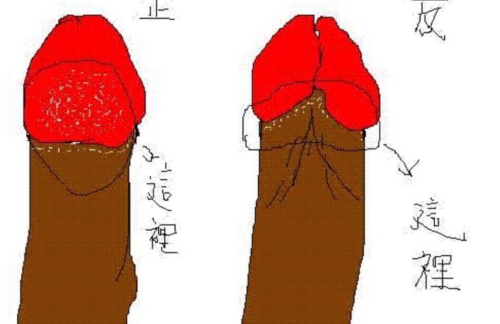 患者如何选择王文卫和杨克冰医生