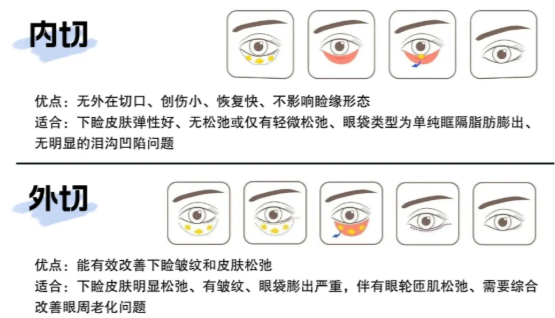 无锡施尔美祛眼袋医生介绍