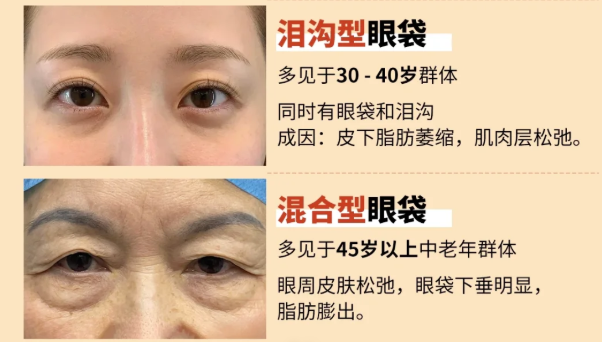 无锡施尔美祛眼袋真实反馈:姚义超/樊佃怀的“用户真话”