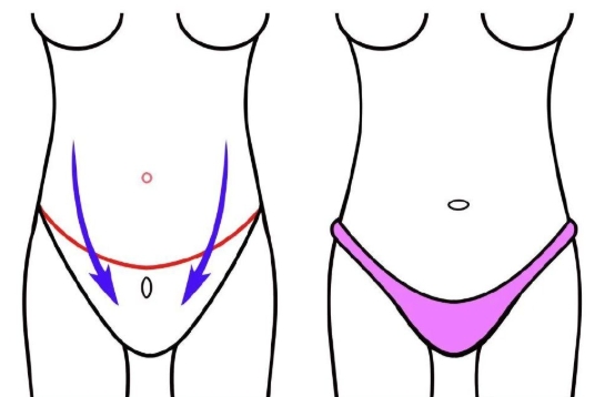 万晓楠做3s人鱼体雕
