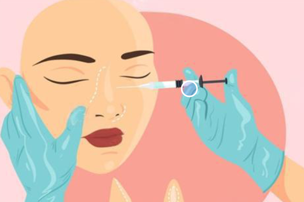 艾丝乐骨性材料填充鼻子会变宽吗