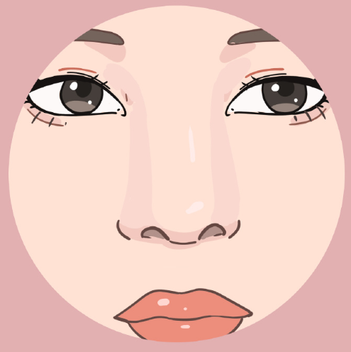 如何避免艾丝乐骨性材料填充鼻子后变宽