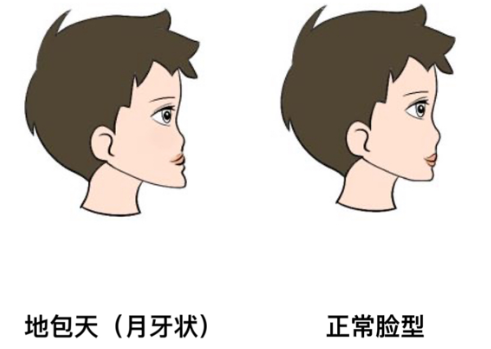 在韩国做过正颌手术的患者体验与评价