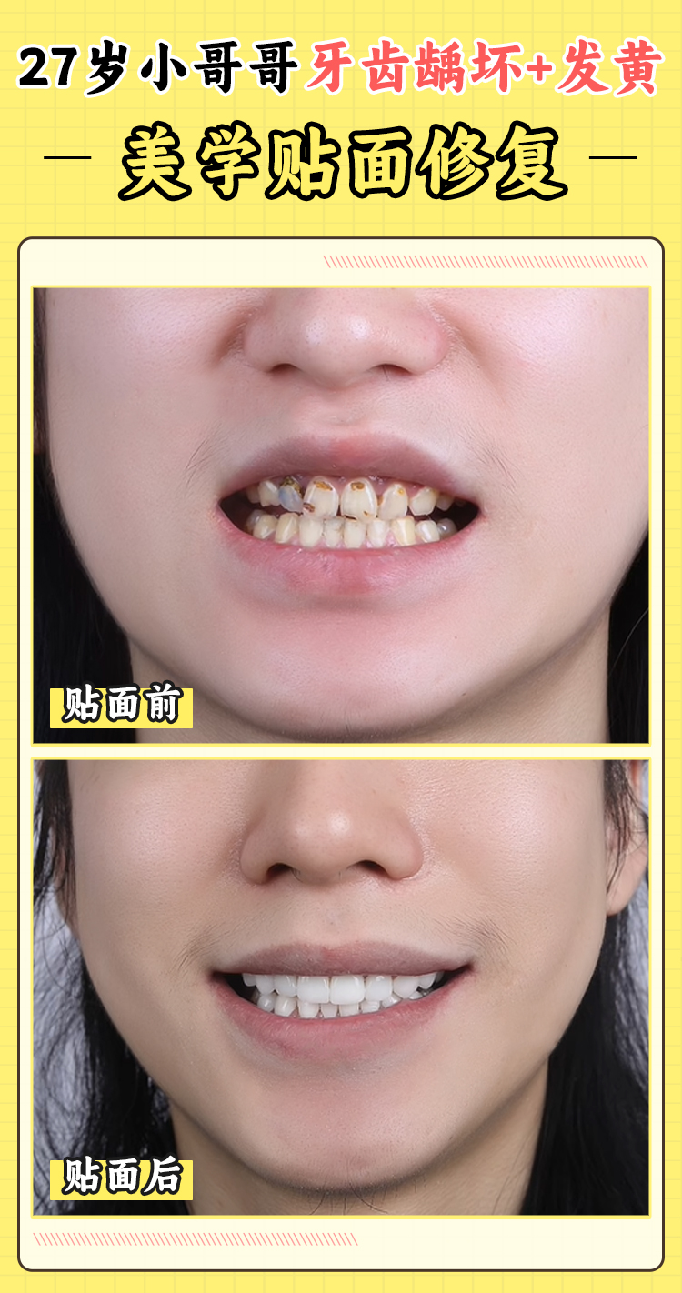 四、牙博士口腔医院可以刷社保卡吗？