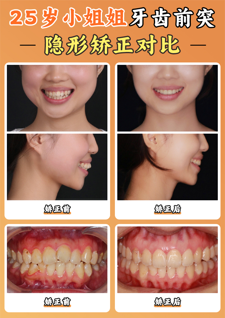 三、南通摩尔口腔医院种植医生的服务与口碑