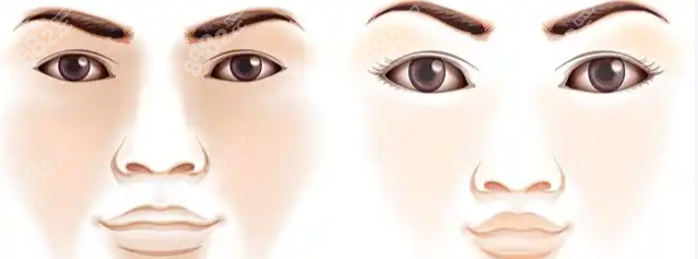 成都王皓民人中縮短價格