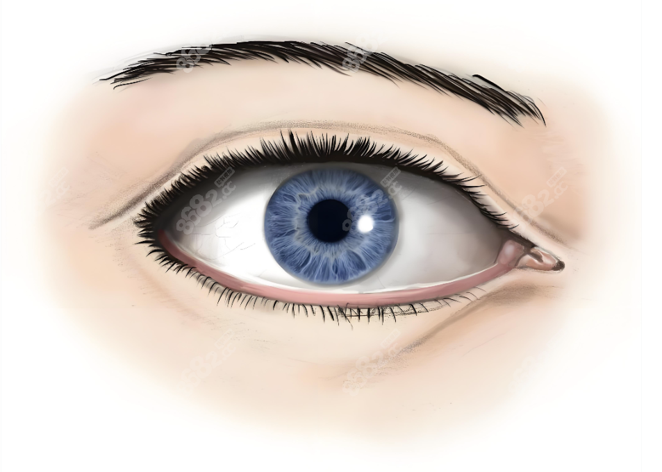 大連劉志剛醫(yī)生修復下眼瞼外翻