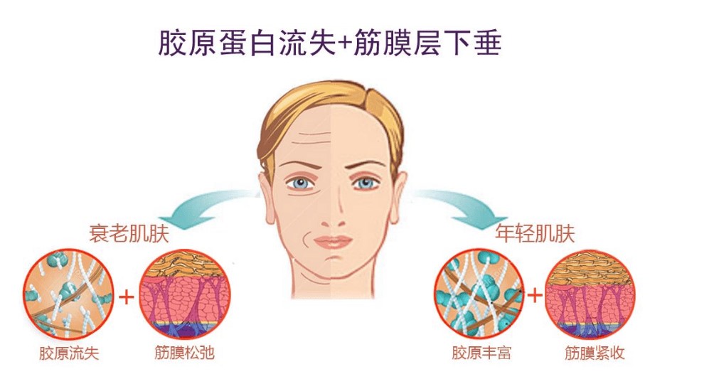 吴芝沅双W复位技术适合哪些脸型