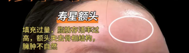 找韩可旺做馒化修复,用户较在意的3个“可靠感”