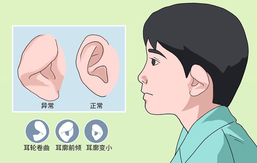 北京杨庆华小耳畸形再造手术评价良好