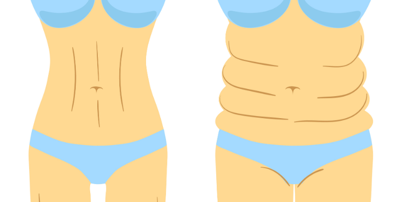 重庆军美章小平吸脂手术价格背后的技术与医院支撑