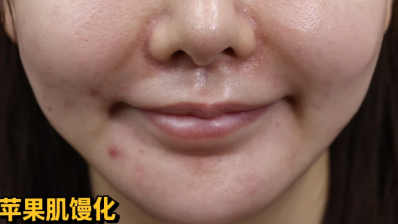 上海韩可旺医生现在在哪上班?找他做馒化提升,怎么联系助理预约