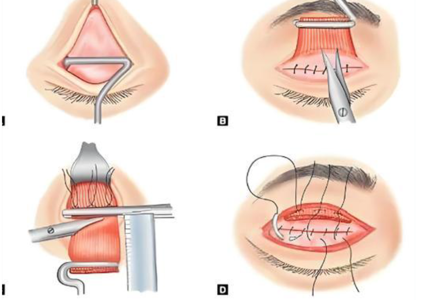 沈干在哪個整形醫(yī)院www.66ub.cn