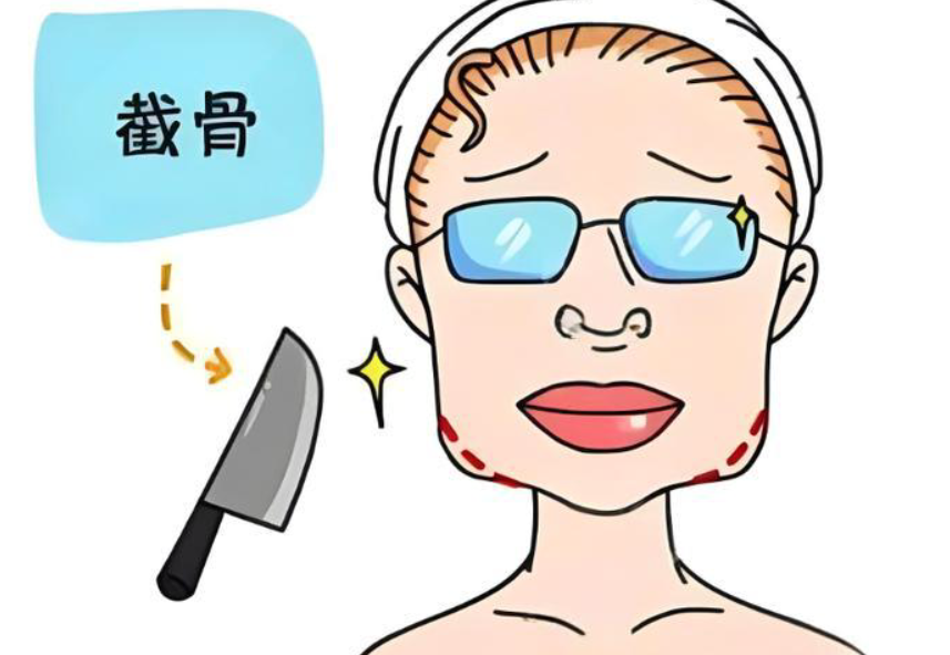 佛山做磨骨手術(shù)哪個(gè)醫(yī)生好的推薦名單