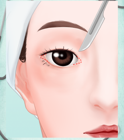 重庆兰宇医生怎么样?是贝兹眼技术研创者,擅长眼修复手术,患者称赞技术细腻