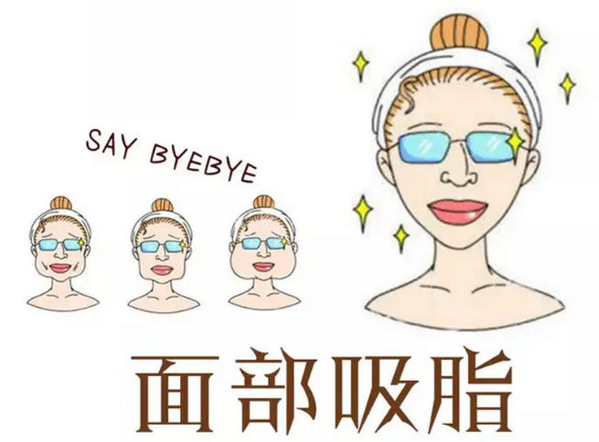 面部吸脂
