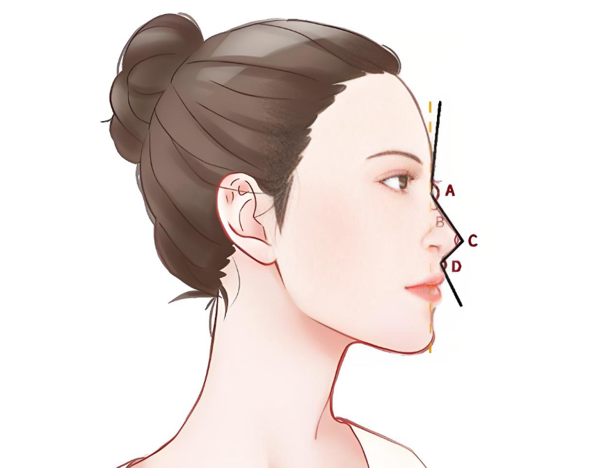 沈陽(yáng)黃威隆鼻價(jià)格大公開！醫(yī)師詳解：從2千到3萬(wàn)，你的鼻子適合哪種方案？