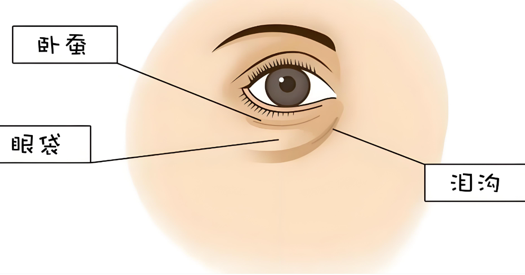 成都健麗去眼袋怎么樣