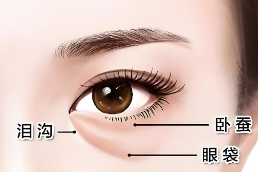 成都健麗去眼袋好不好www.66ub.cn