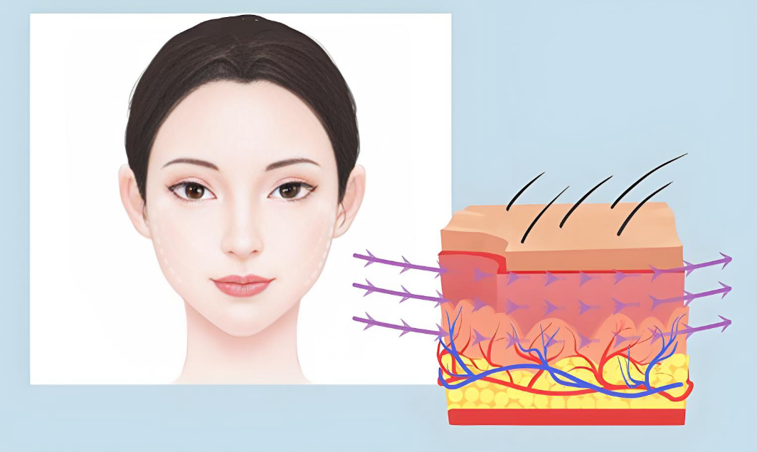 新科普：朱自剛面部提升三件套是不是埋線？真不是埋線！5大區(qū)別一次說(shuō)清，35+姐妹必看