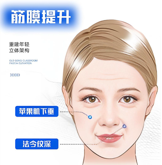 張路整形筋膜提升小拉皮三件套怎么樣