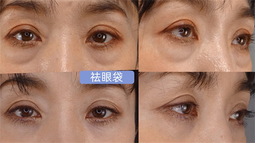 重慶楊東運(yùn)祛疤是騙人的嗎?修復(fù)疤痕切縫靠譜，多案例反饋痕跡近乎無