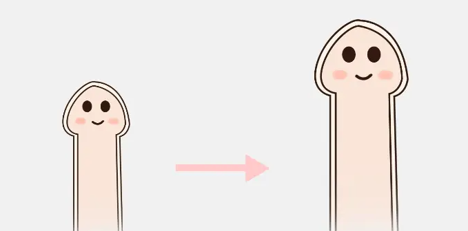 李世荣阴茎延长术患者真实评价与体验