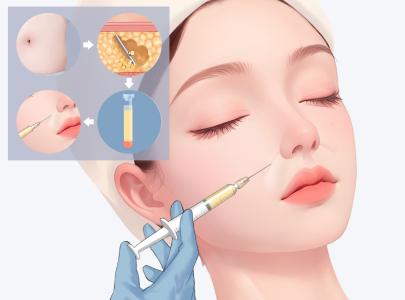 西安王愛武和張偉誰技術(shù)好？王愛武擅長(zhǎng)淺表異物，張偉專攻復(fù)雜彌散異物