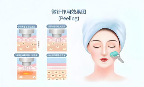 西安黄金微针医院排名