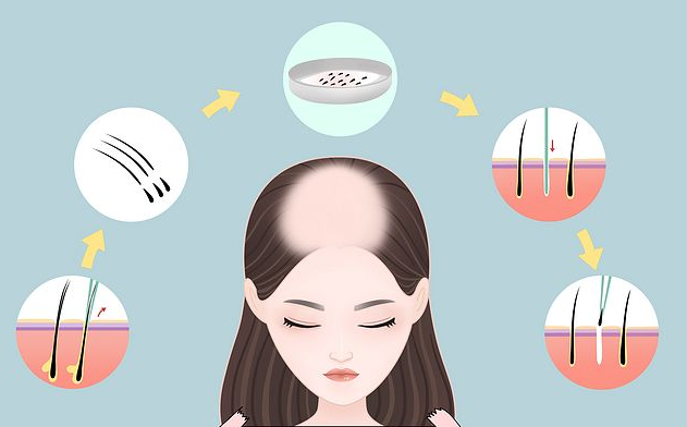 国内植发医院排名前十名之各医院详情