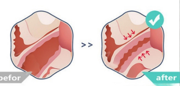 上海打私密缩紧针口碑好医院名单