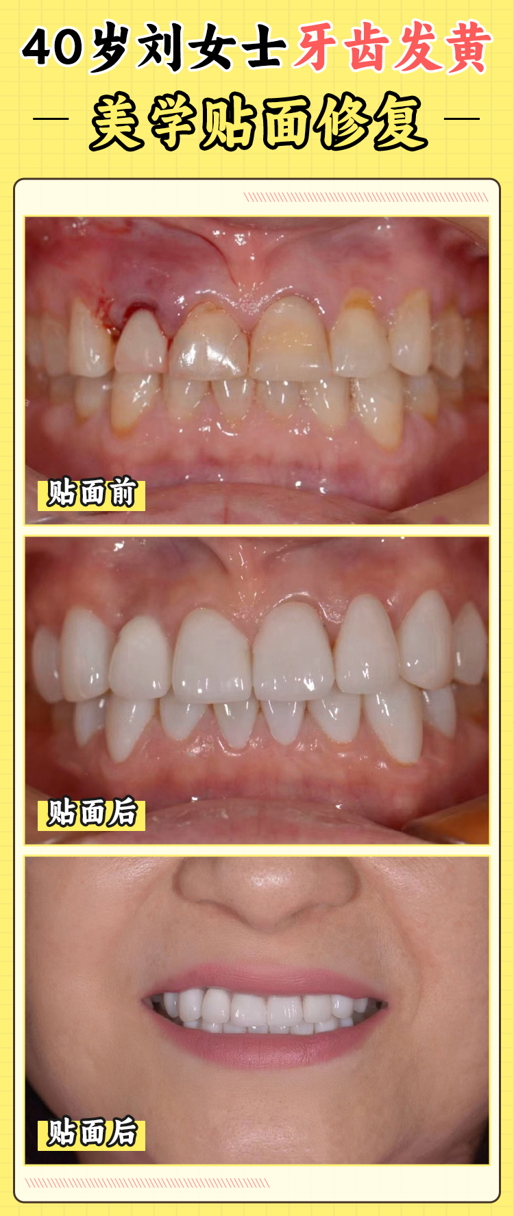 一、西安團(tuán)圓口腔醫(yī)院張保平醫(yī)生基本信息