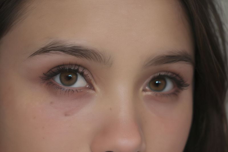 三、兰州普瑞眼视光医院飞秒手术特色