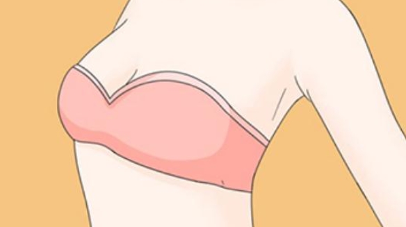 唐志榮做自體脂肪隆胸怎么樣m.66ub.cn