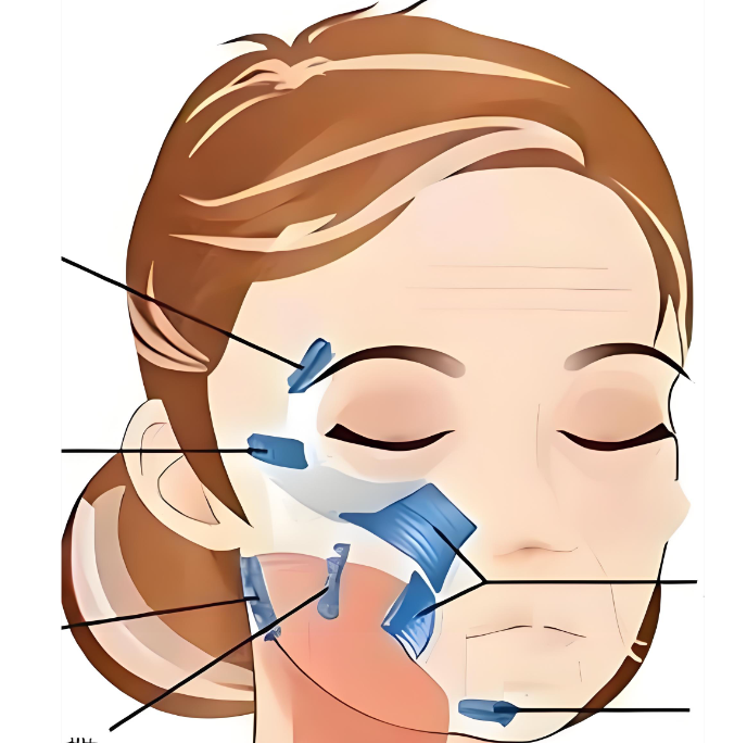 北京王易彬钻石网面部提升
