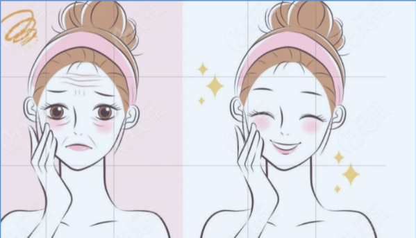 杭州幼态脸打造