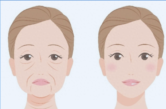 杭州幼态脸打造