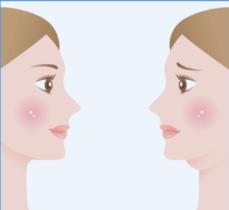 杭州幼态脸打造