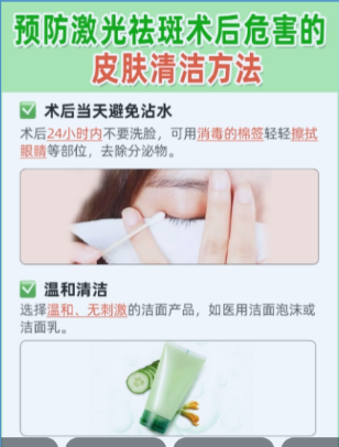 激光祛斑