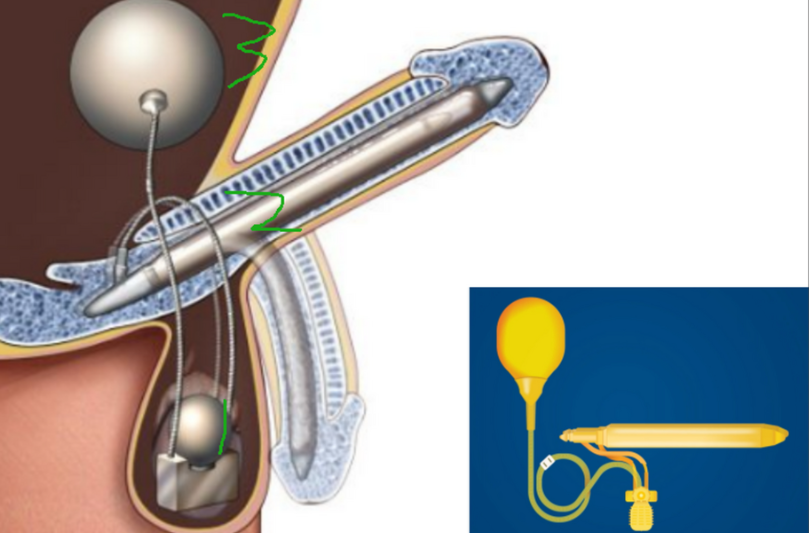 關(guān)于AMS700增粗型價格，用戶較常問的3個問題，一次性說清楚
